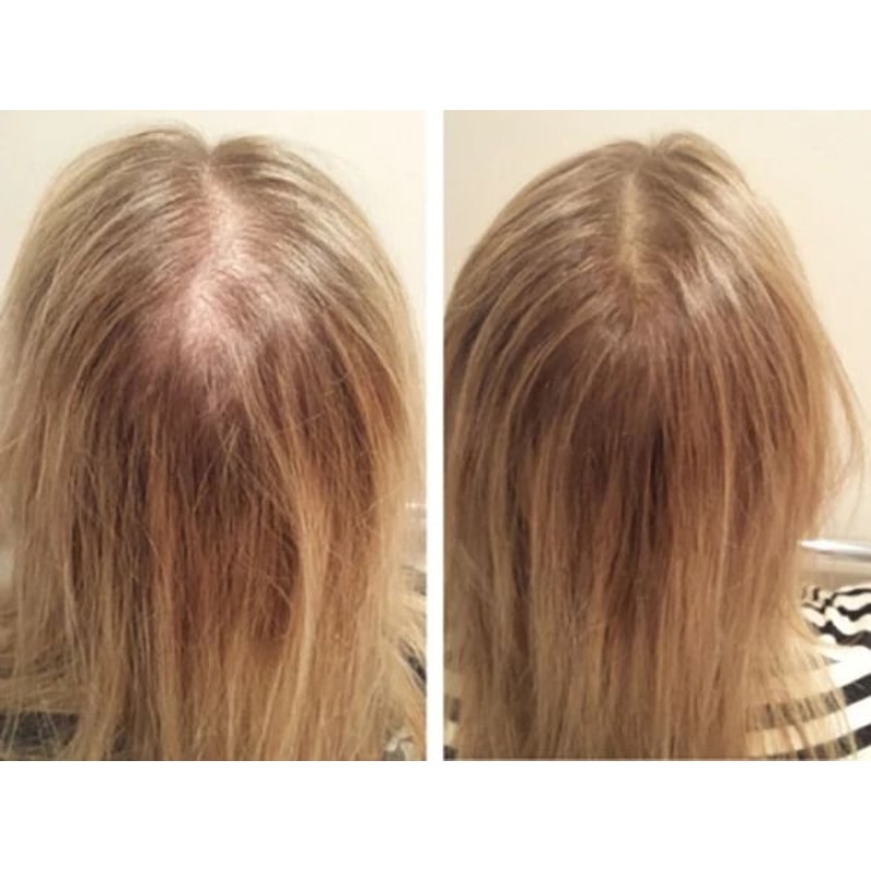 Best Fast Hair Loss Regrowth Shampoo With Organic Oils For Men Women 4