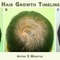 Best Fast Hair Loss Regrowth Shampoo With Organic Oils For Men Women 5