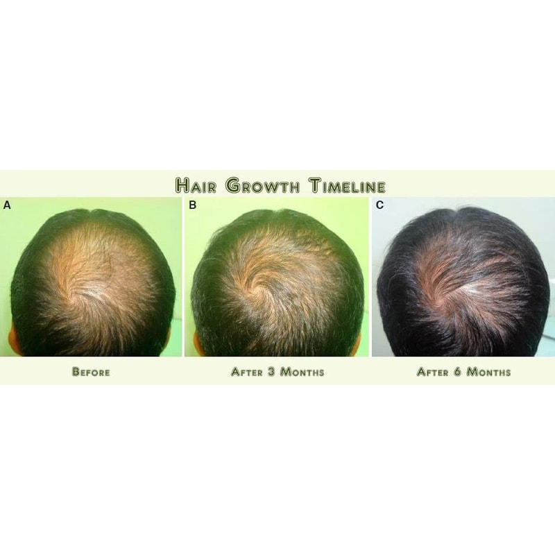 Best Fast Hair Loss Regrowth Shampoo With Organic Oils For Men Women 5