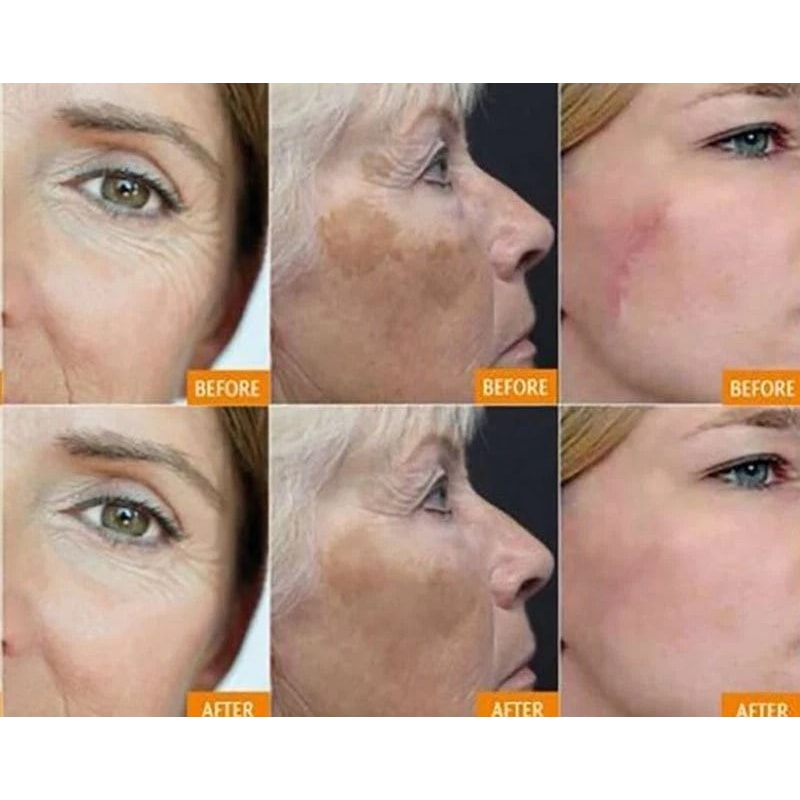 Enchanted Waters Dead Sea Mud Mask Anti Aging Acne Treatment Pore Minimizer 4