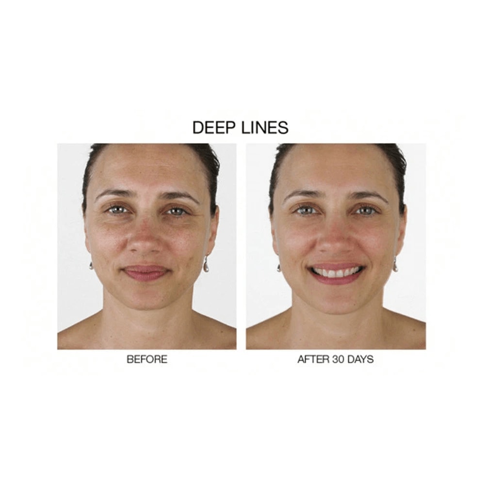 Stem Cell Serum For Anti Aging Wrinkle Reduction And Collagen Boost With Hyaluronic Acid 2