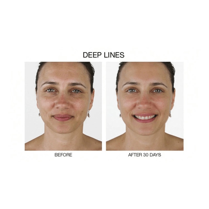 Stem Cell Serum For Anti Aging Wrinkle Reduction And Collagen Boost With Hyaluronic Acid 2