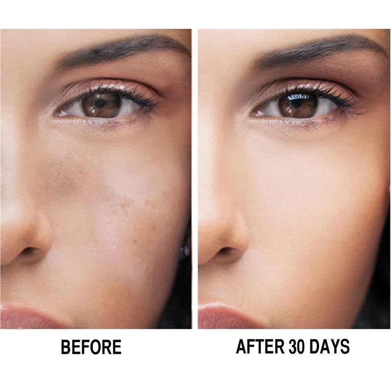 Kojic Acid Brightening Serum 1oz Dark Spot Treatment Uneven Skin Tone Solution 4