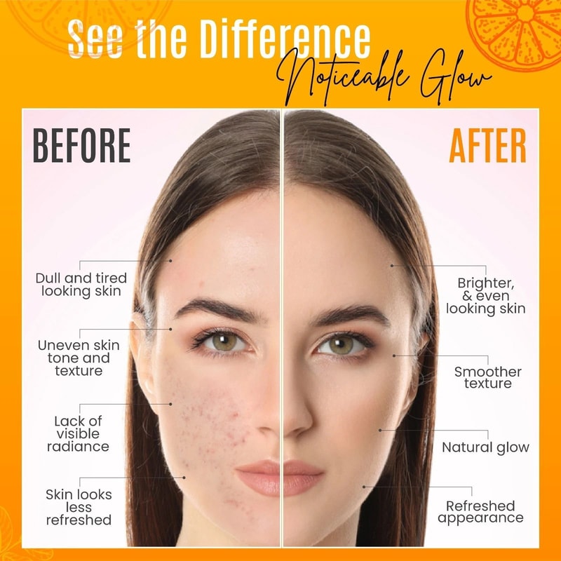 Pure Vitamin C Serum With Hyaluronic Acid Antioxidants For Youthful Skin 2