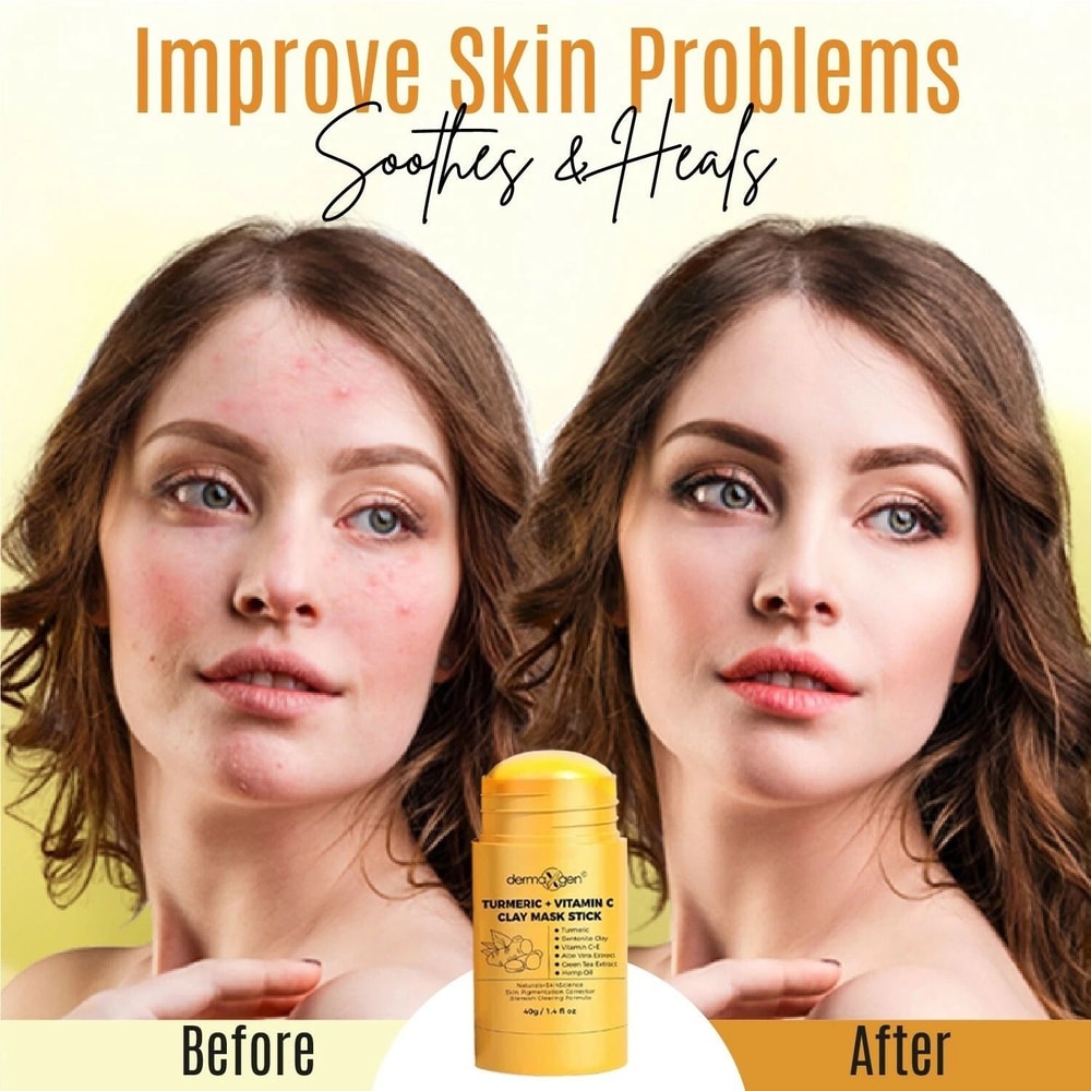 Turmeric Face Mask Stick Pigmentation Blemish Corrector For Dark Spots 2