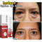 Instant Eye Bag Remove Eye Cream Korean Beauty Eye Care Fade Dark Circles Puffiness Lift Brighten A 5