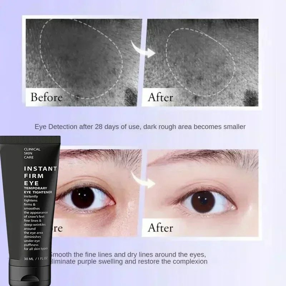 Collagen AntiWrinkle Firming Eye Cream 10 Instant Eye Bag Removal Cream Fade Fine Lines Anti Dark C 4