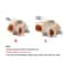 Professional Grade Silicone Toe Separators Bunion Corrector Orthopedic Pedicure Tools For Pain Reli 1