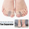 Professional Grade Silicone Toe Separators Bunion Corrector Orthopedic Pedicure Tools For Pain Reli 2