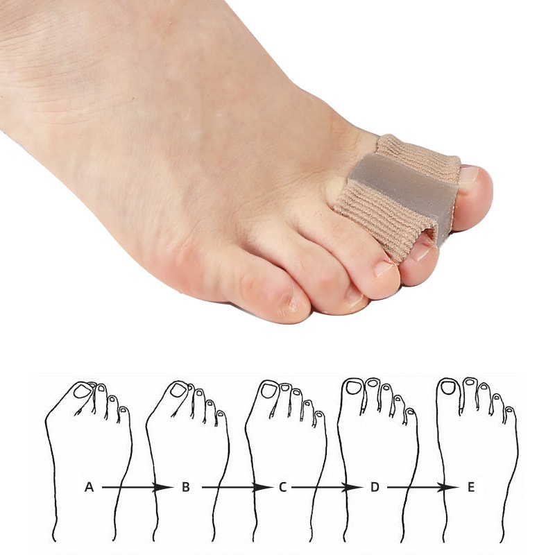 Professional Grade Silicone Toe Separators Bunion Corrector Orthopedic Pedicure Tools For Pain Reli 3