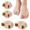 Professional Grade Silicone Toe Separators Bunion Corrector Orthopedic Pedicure Tools For Pain Reli 0