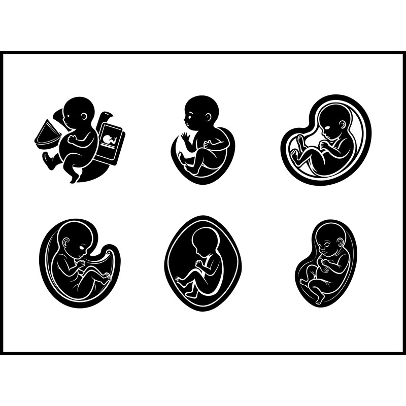 Fetus SVG Bundle 1