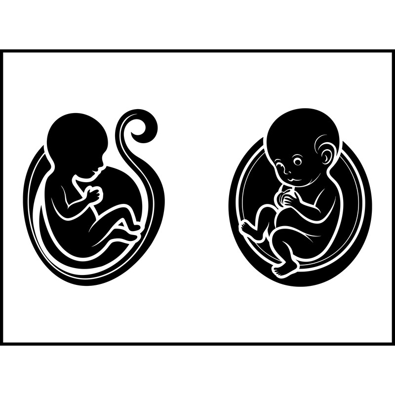Fetus SVG Bundle 2
