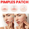 Repair Acne Patch Facial Skin Care Fade Blemishes Pimple Marks Closed Acne Blemishes Cover 3