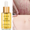 Postpartum Repair Essential Oil Fade Stretch Marks Fat Lines Big Belly Recovery Body Massage Oil Sk 2
