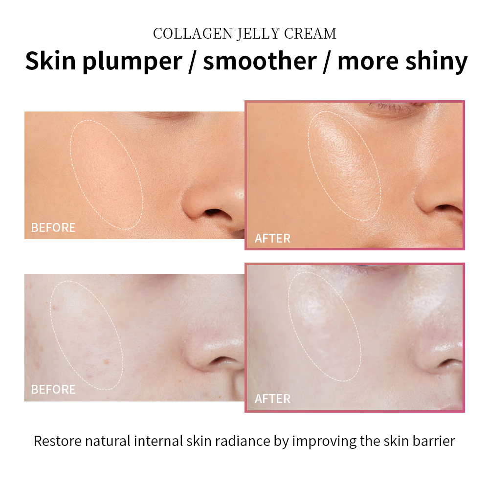 Moisturizing Collagen Jelly Cream Niacinamide Hydrolyzed Collagen Tightening Soothing Anti Aging Fi 3