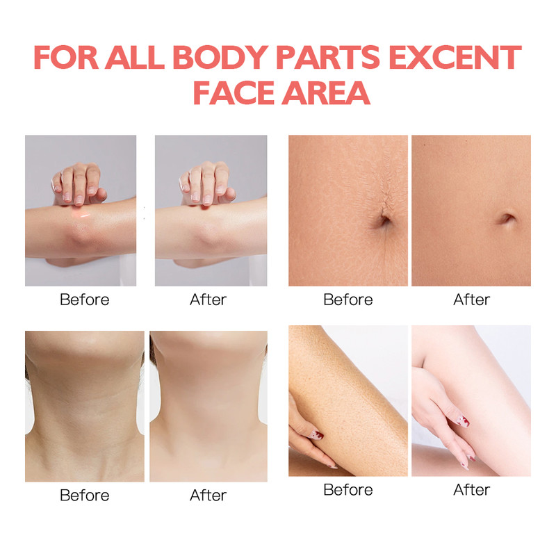 Glossy Body Serum for Wrinkles Smoothing, Hydrating Nourishing Repair, Body Serum Hyaluronic Acid, Skin Booster