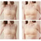 LaceLift Invisible Strapless Bra for Women Non Slip Push Up Support