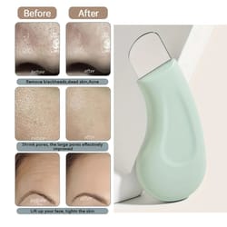 black head and white head removal tool for nose and face, pore cleaner skin care tools for women