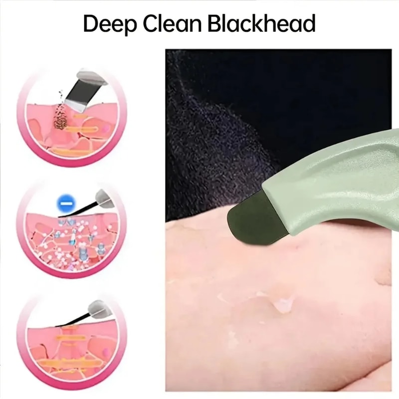 Black head and White head Removal Tool for Nose and Face, Pore Cleaner Skin Care Tools for Women