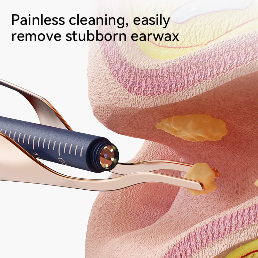 Upgraded Smart Visual Ear Wax Cleaner With Camera Endoscope MultiFunctional Ear Cleaning Tool 4