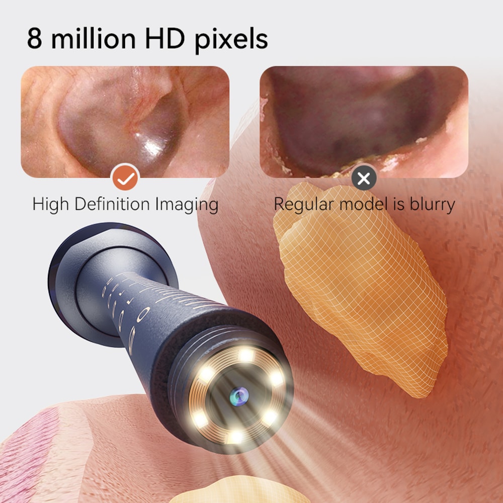 Upgraded Smart Visual Ear Wax Cleaner With Camera Endoscope MultiFunctional Ear Cleaning Tool 5