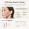 RF EMS Beauty Device With 3Color Light For Skin Tightening And AntiAging 2