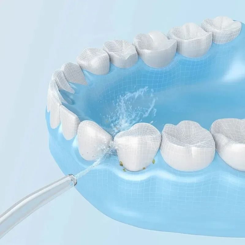 Portable Ultrasonic Oral Irrigator For Deep Teeth Cleaning 1