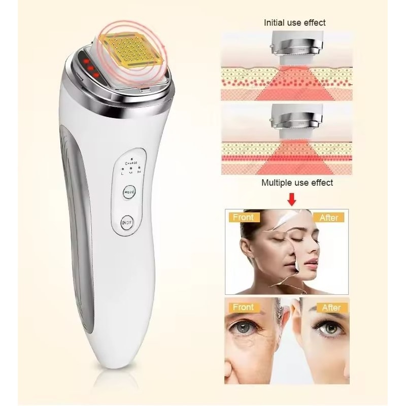 RF Radio Frequency Face Lifting Device Beauty Massager Wrinkle Remover 4