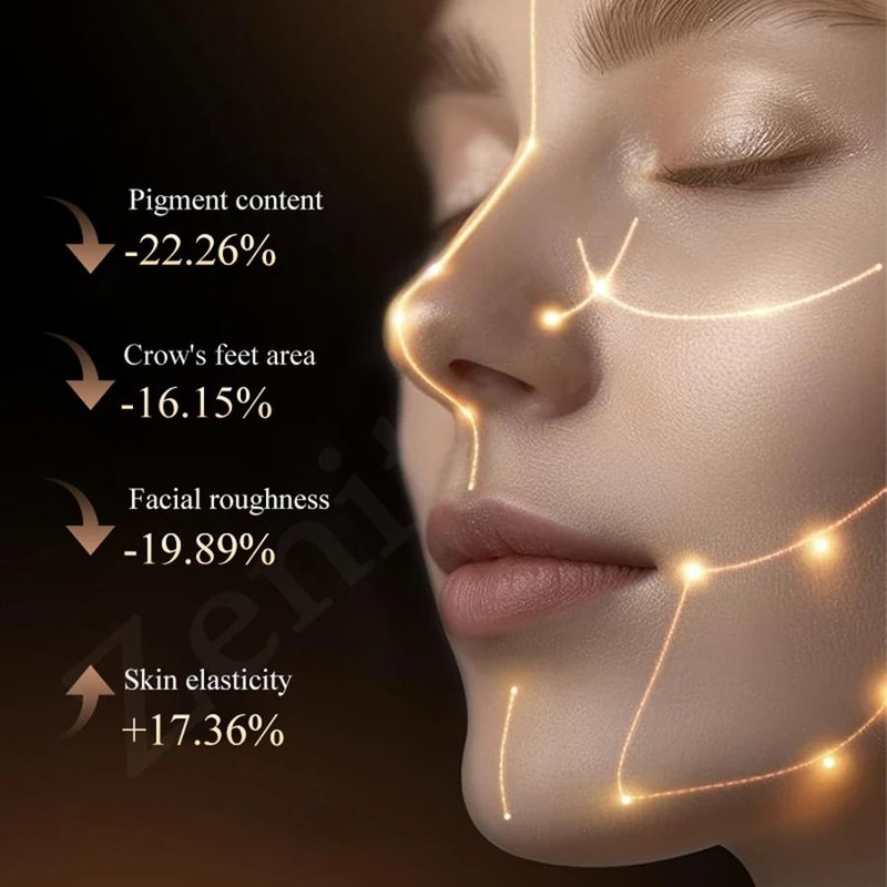 2 In 1 Skin Rejuvenation Device With DPL Milk Light And Anti Wrinkle Care 4