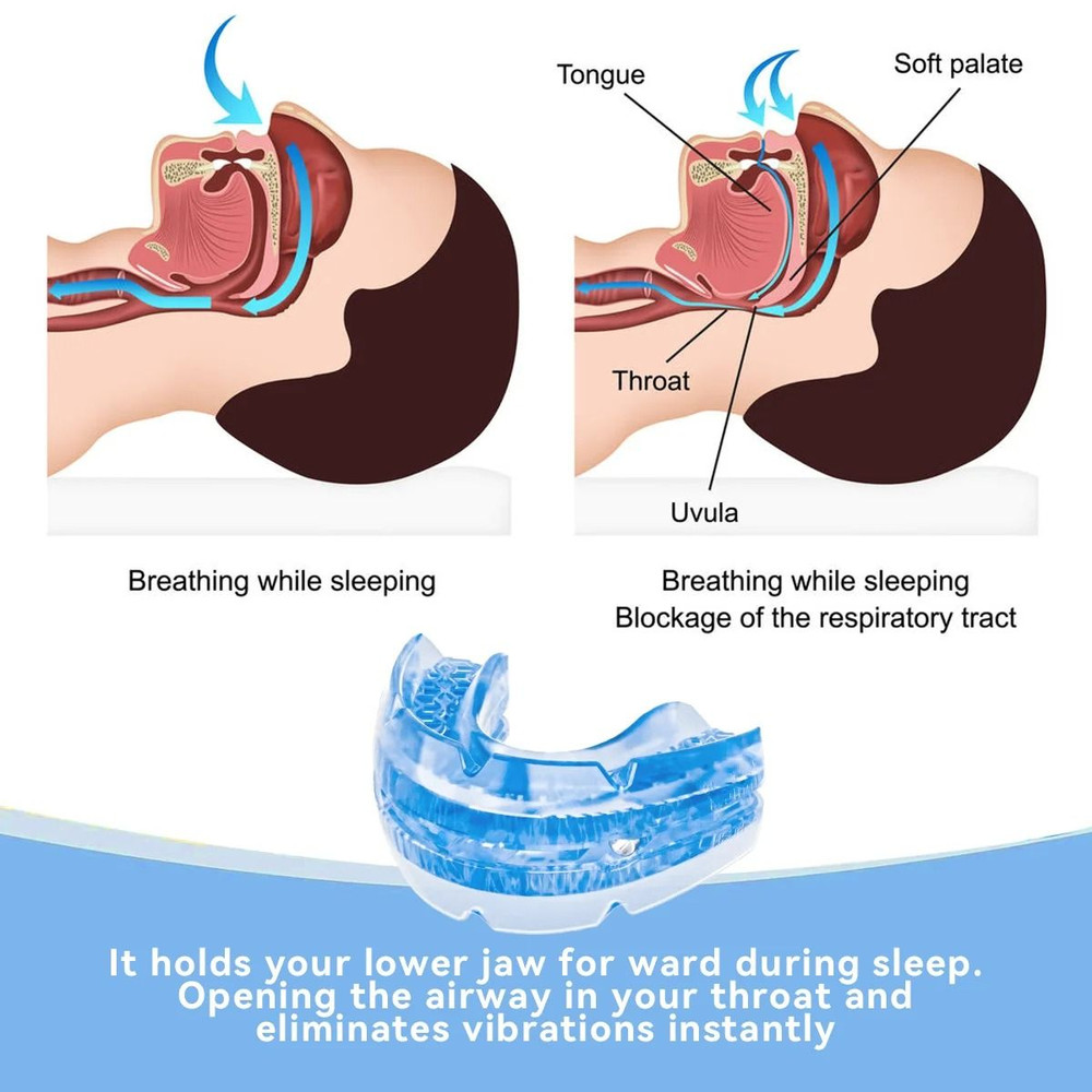 Anti Snore Mouth Guard Bruxism Night Sleeping Aid 3