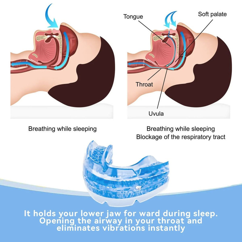 Anti Snore Mouth Guard Bruxism Night Sleeping Aid 3