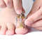 Toenail Correction Bracket Tool For Ingrown Nail Treatment And Paronychia Care 2