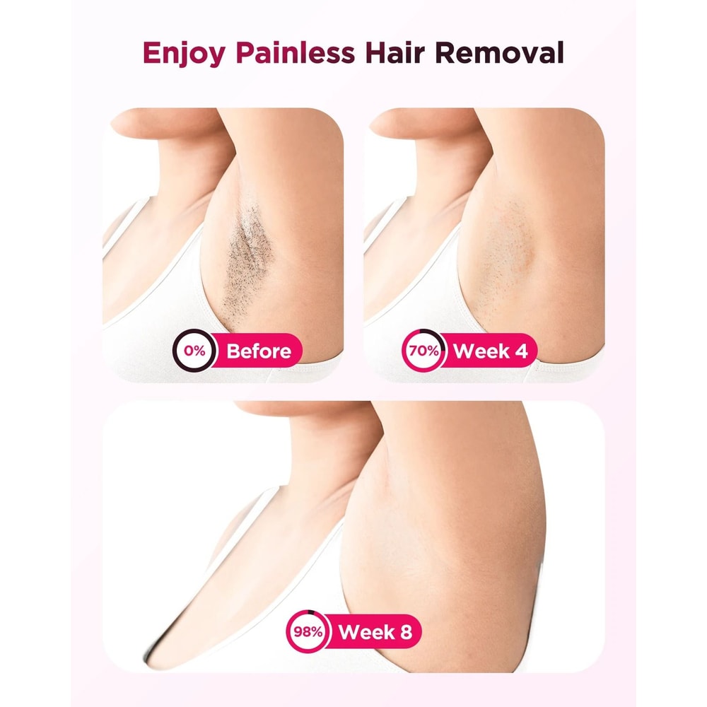 IPL Hair Removal Device With 990000 Flashes For Painless Permanent Hair Reduction 5