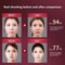 LED Photon Therapy Facial Lifting Device With Heat And Vibration 6