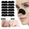 Nose Blackhead Remover Mask 0