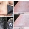 Nose Blackhead Remover Mask 3