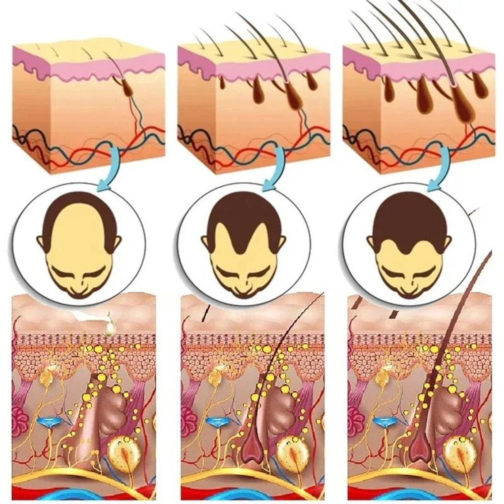 7 Days Ginger Hair Growth Serum  FastActing Natural Hair Regrowth Oil For Thicker Fuller Hair And S 3