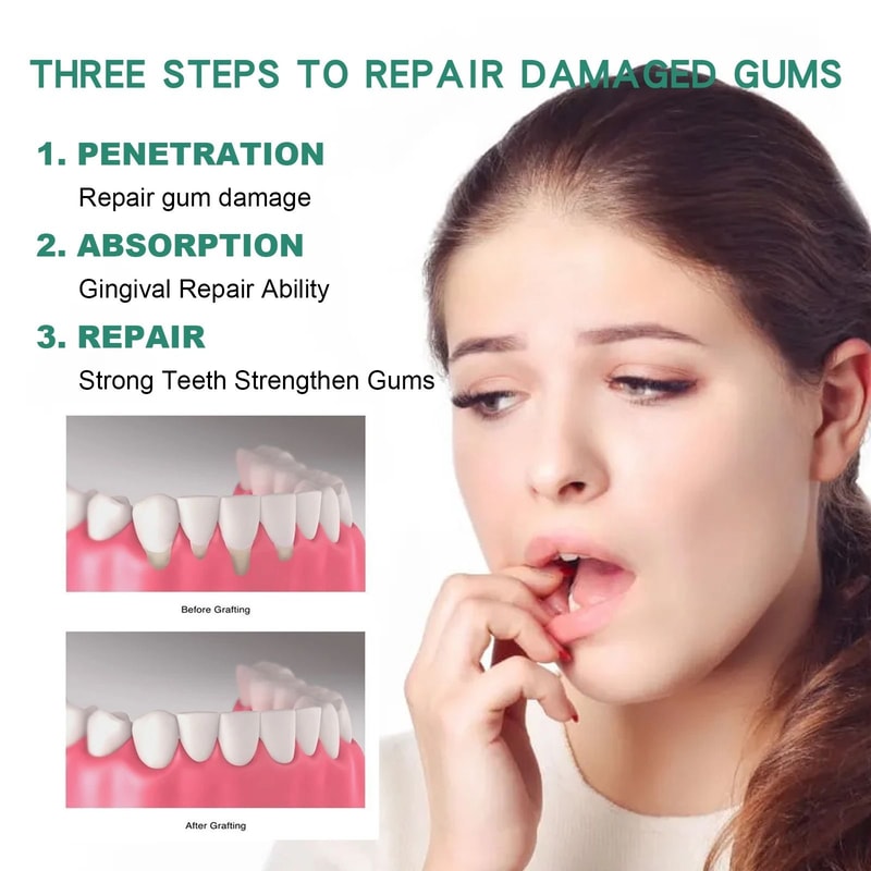 Gum Care Repair Drops For Daily Oral Hygiene 4