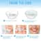 Anti Snoring Mouth Guard For Comfortable Night Sleep 5