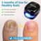 Nail Care Laser Device For Improving Nail Appearance And Smoothness 1