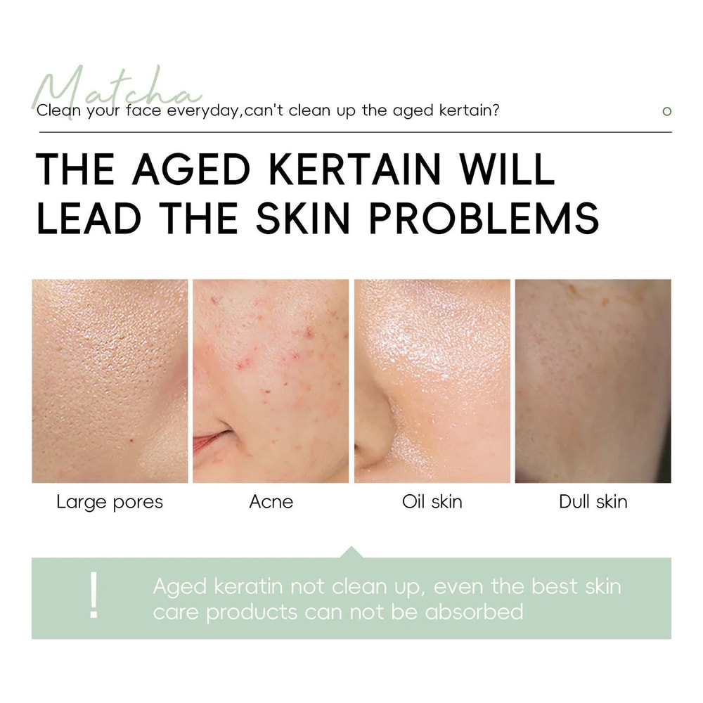 Matcha Exfoliating Gel For Deep Cleansing And Skin Renewal 60g 4