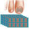 Nail Correction Stickers For Ingrown Toenail Care 0