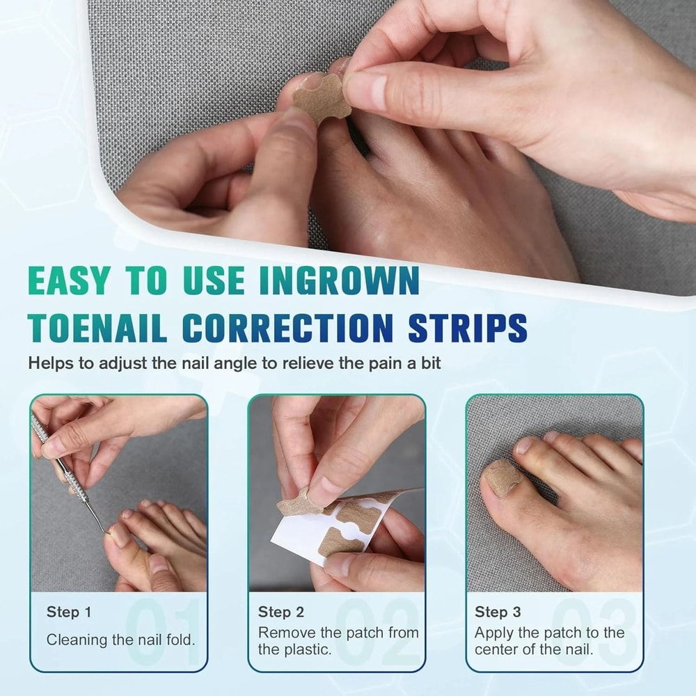 Nail Correction Stickers For Ingrown Toenail Care 2