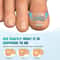 Nail Correction Stickers For Ingrown Toenail Care 3