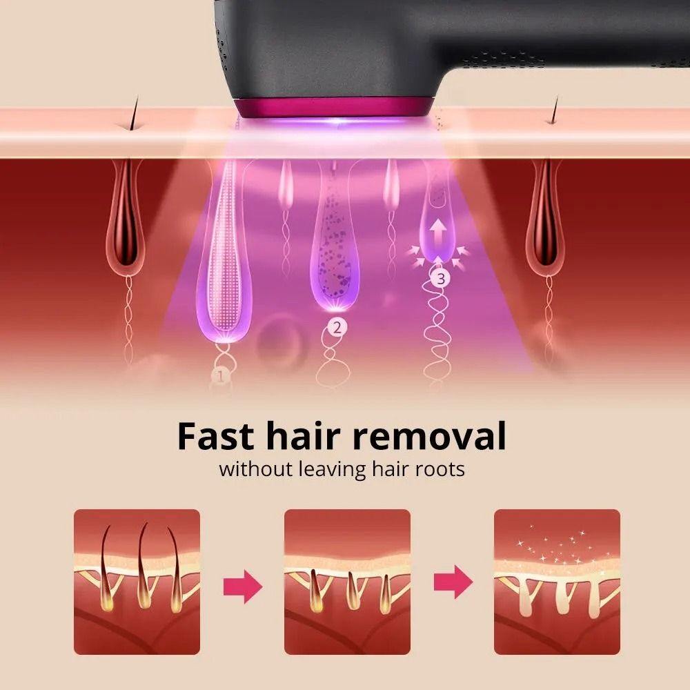 IPL Hair Removal Device For Home Use With 5Speed Pulse Light And 100000 Flashes 2