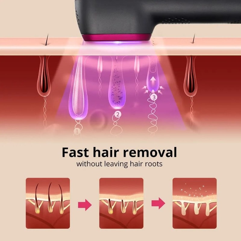 IPL Hair Removal Device For Home Use With 5Speed Pulse Light And 100000 Flashes 2