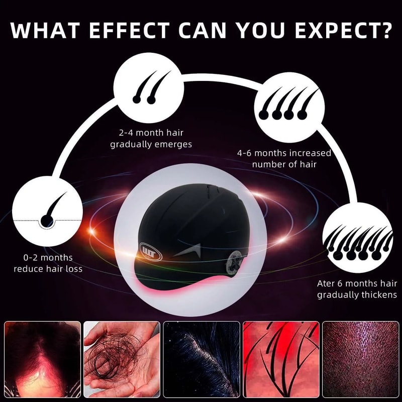 LLLT 650nm Laser Hair Growth Helmet 4