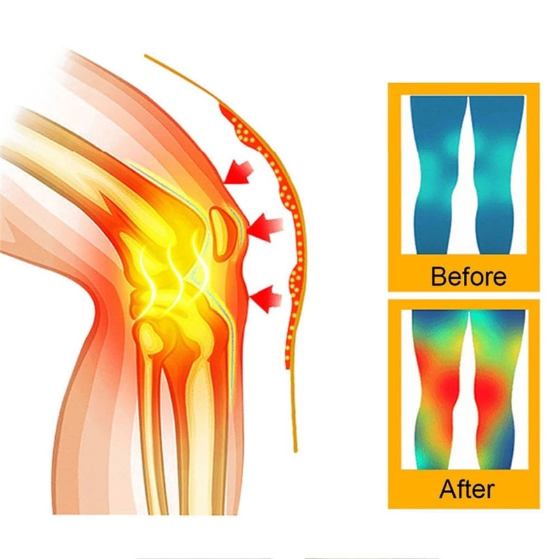 SelfHeating Knee Support Braces 2Piece Warm Compression Sleeves For Joint Relief 1