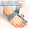 Adjustable Rotatable Bunion Corrector 4